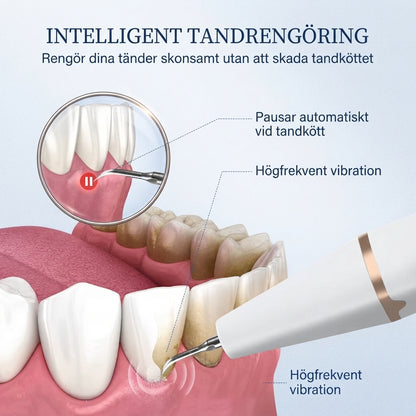 Dentara Pro™ - Ultraljuds tandrengörare
